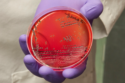 Picture: FDA/Flickr. Salmonella growing in a petri dish. FDA's Center for Food Safety and Applied Nutrition (2012)