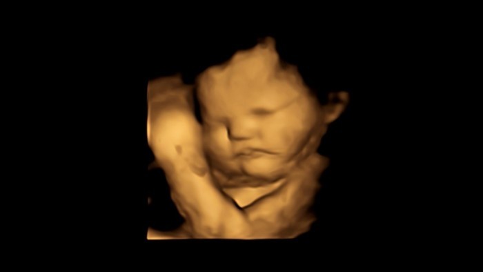 Image: a 4d scan image of a fetus showing a neutral face. Credit: Fetal and Neonatal Research Lab.
