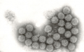 Rotavirus. Picture: The Agri-Food & Biosciences Institute (AFBI)