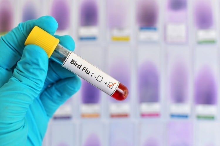 Human-case-of-avian-influenza-in-China.jpg
