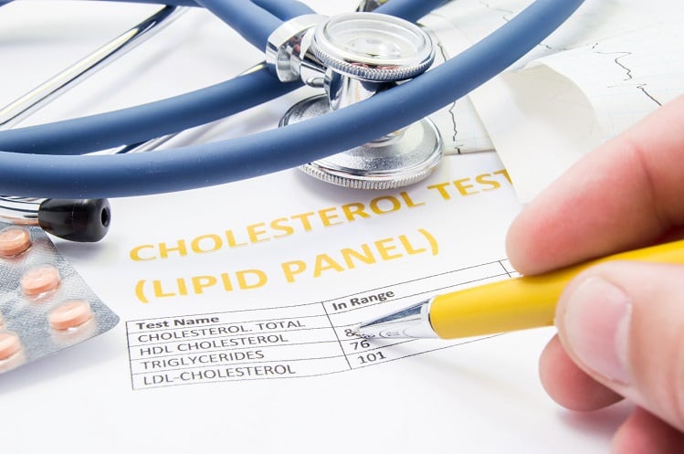 Review-finds-link-between-selenium-and-some-cholesterol-lowering-benefits.jpg