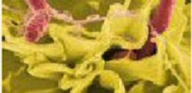 salmonella.png