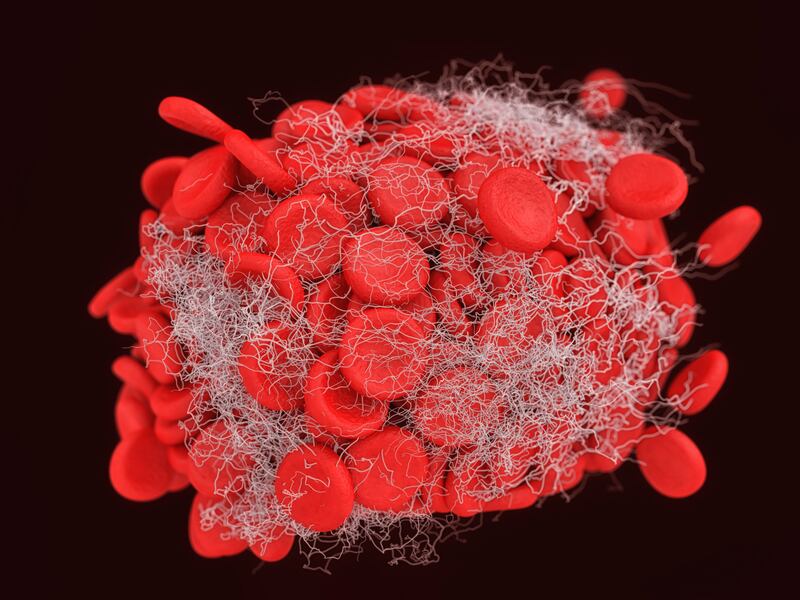 blood-clot-cardiovascular-heart-stroke-iStock-somersault1824.jpg