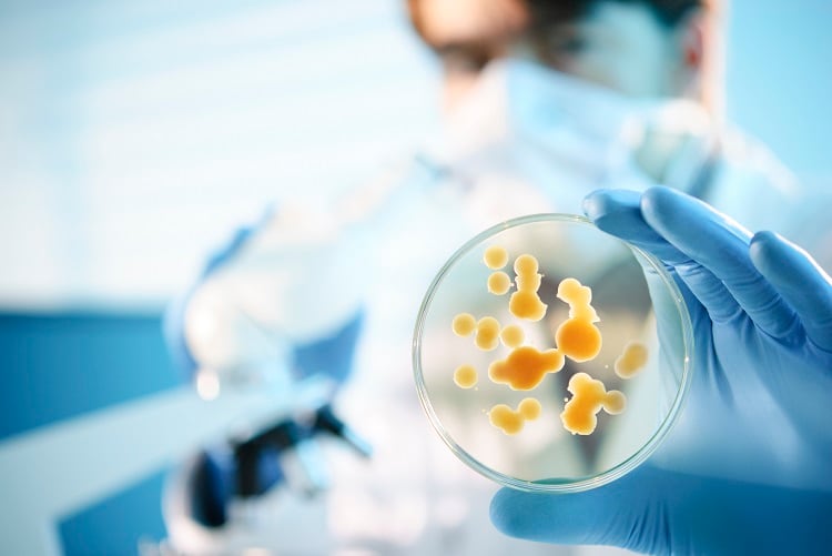 How can microbial quality control help reduce food waste? 