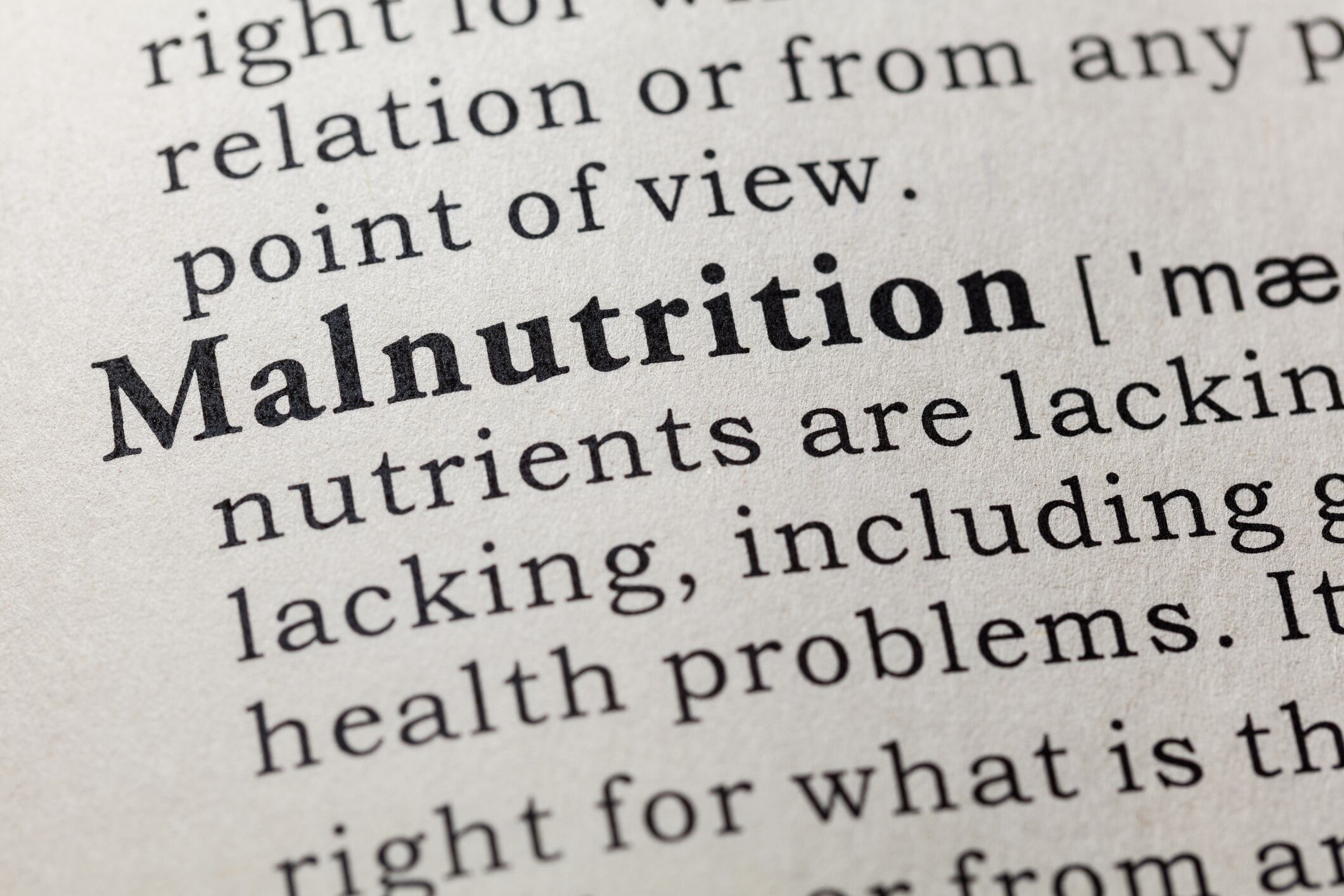 Lancet study highlights 'shocking' malnutrition findings
