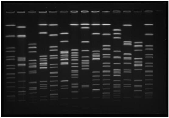 ecdc-pfge-salmonella-good.png