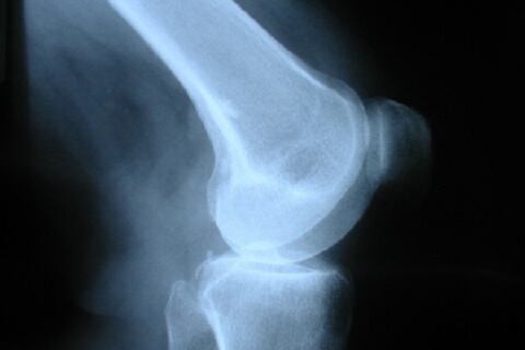 Knee.jpg
