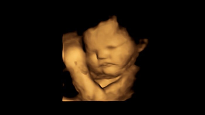First direct evidence that babies can taste and smell in the womb