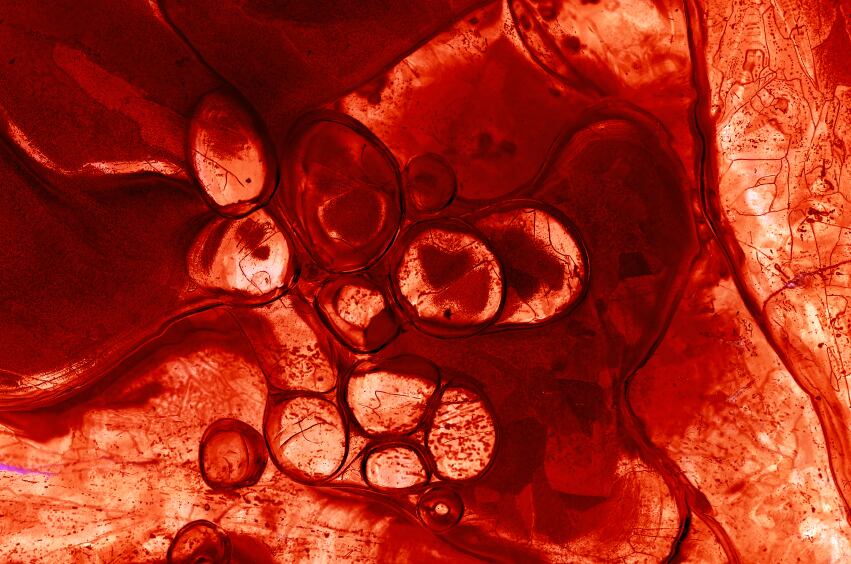 blood-iron-iStock.com-Michal-Boubin.jpg
