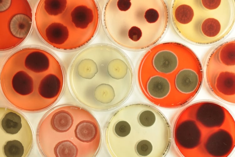 Chromologics: Precision fermentation addresses ‘main challenges’ facing natural colours