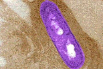 listeria-CDC.png