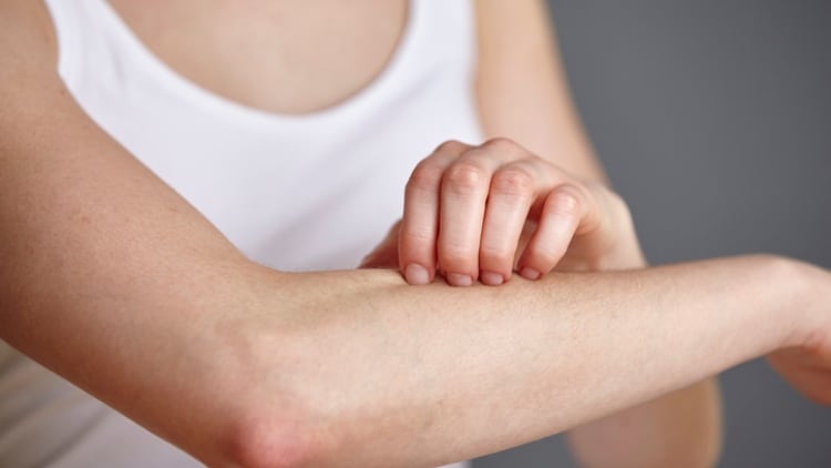 Food allergy fears: New survey reveals insufficient data, research, and management in most APAC countries