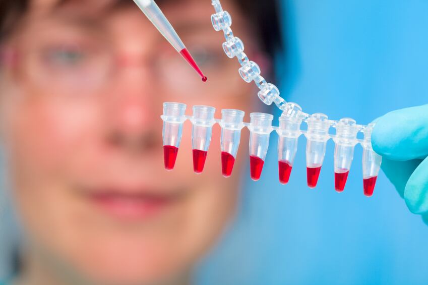research-study-lab-blood-sample-iStock.com-luchschen.jpg