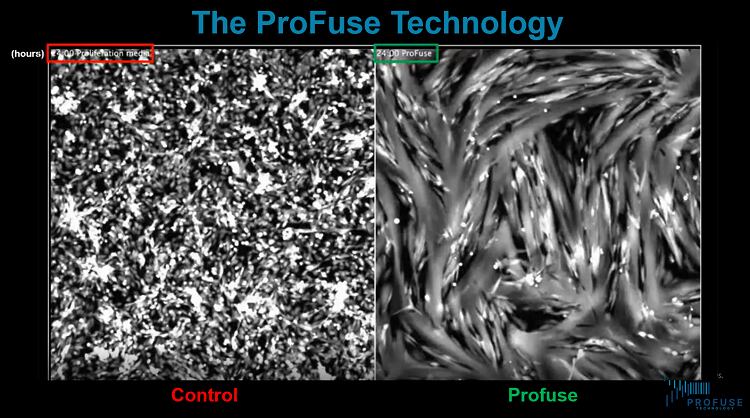 fibres-profuse.png