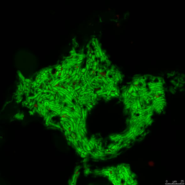 Fungal-protein.png