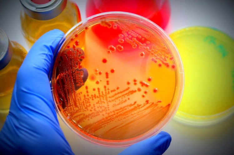 China's probiotic market: Huge interest in products for weight management – Lumina Intelligence data