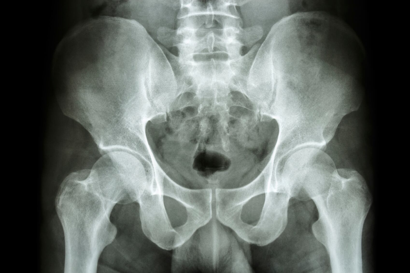Hips-C-stockdevil.jpg