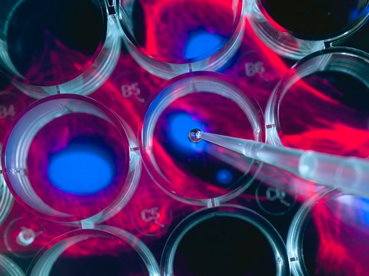 ‘A defining feature of stem cells is that they can become other cells’: Strategies for the use of stem cells in cultivated meat production