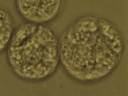 Photomicrograph-of-the-micro-algae-Schizochytrium-courtesy.jpg