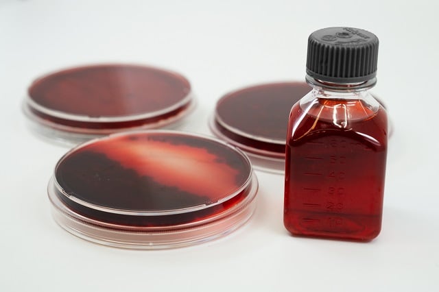Argentinian start-up develops 'novel compound' food colors from fungi