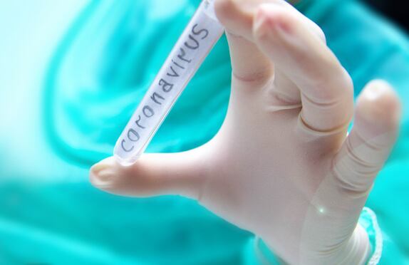 Coronavirus-COVID-19-fears-could-cut-Expo-West-attendance-by-as-much-as-60.jpg