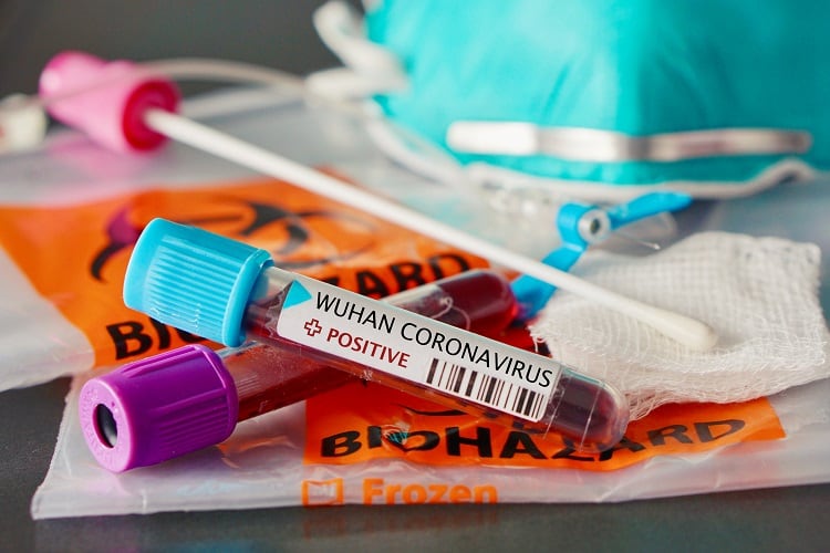 Can coronavirus be transmitted via imported food?