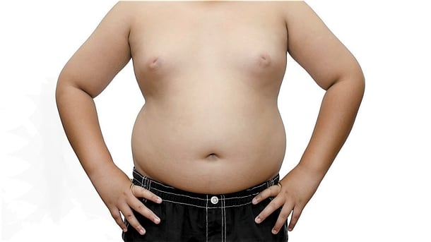Obesity.jpg