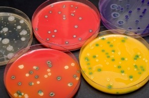 Bacteria plates