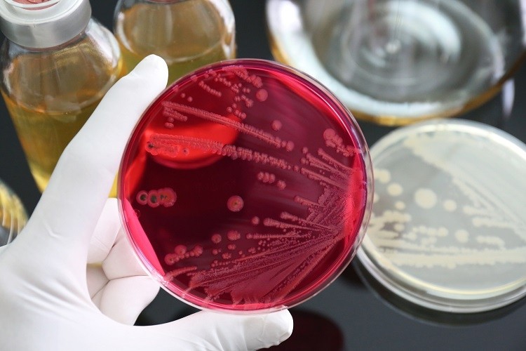 Infections with foodborne bacteria becoming harder to treat