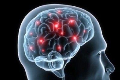 Western diet may cause brain impairment and neurodegenerative disease