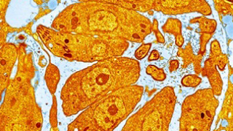Coloured transmission electron micrograph of T.gondii parasites inside a human cell (Picture: NHS)