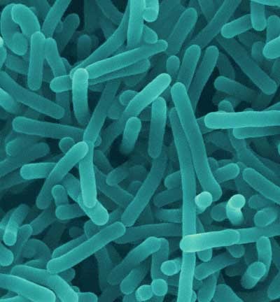 A total of 270 people died from listeriosis in 2009
