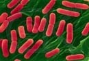 The Establsihment 761-linked E.coli contamination has sickened one person in Canada to-date