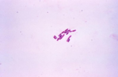 A Gram-stained photomicrograph of rod-shaped, Bacillus cereus bacteria. Picture: CDC/ Dr. William A. Clark