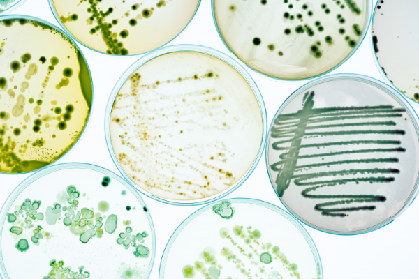 GettyImages-luchschen microbial microbes petri dishes safety contamina
tion