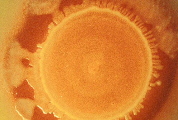 A large colony of Salmonella enteritidis. Picture: Jean Guard