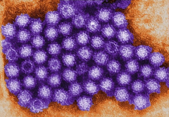 Norovirus photo courtesy of CDC / Charles D. Humphrey