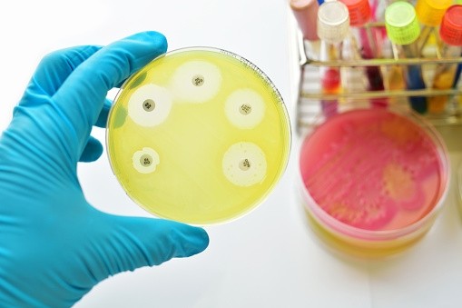 An action plan to tackle antibiotic use has been developed by the FAO