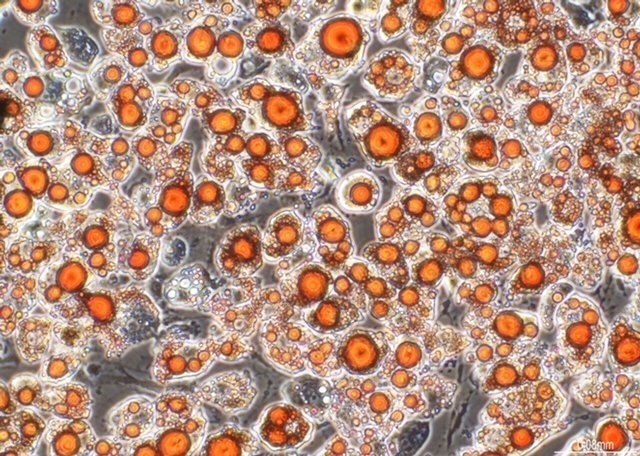 Fat cells produced from Roslin Tech’s pig cell lines / Pic: Roslin 