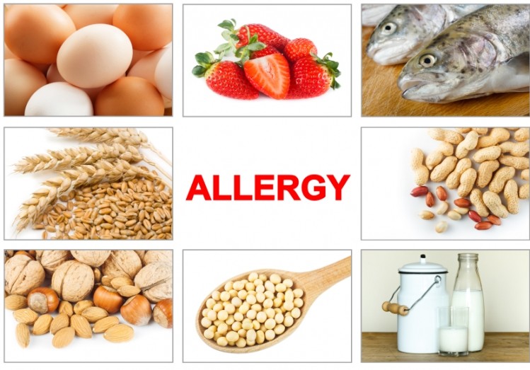 Asda, Foodmaestro want to make it easier to shop with food allergies ©iStock/piotr_malczyk
