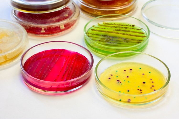 Picture: iStock. Campylobacter, Listeria and STEC infections also increased