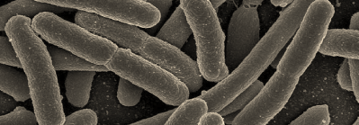 E.coli oubreak update from Northern Ireland agency