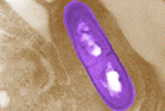 DoD Food Analysis and Diagnostic Laboratory adopts Atlas. Listeria picture: CDC
