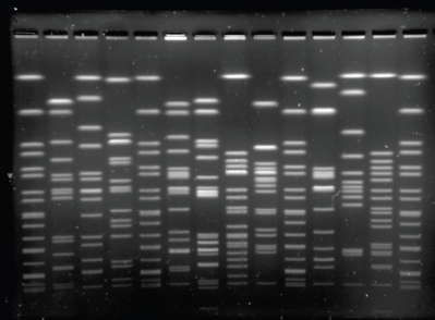 Picture copyright: ECDC. A gel that scored high for 7 pre-identified parameters