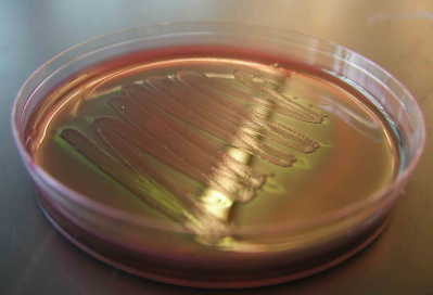 E.coli on a Petri plate (Picture copyright: Anthony D'Onofrio)