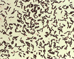 Picture: CDC. Clostridium perfringens bacteria grown in Schaedler's broth