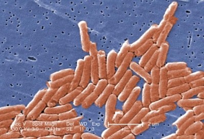 Salmonella. Picture: Janice Haney Carr, Centers for Disease Control and Prevention