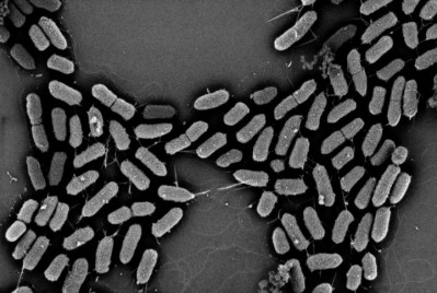 Picture: Edward Dudley. E.coli sticking to human cell lines seen by an electron microscope