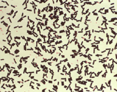 Picture CDC: Clostridium perfringens. The pathgoen contaminated chicken