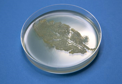 Picture: University of Leicester. Salad leaf microbe prints on Luria Agar Media plates